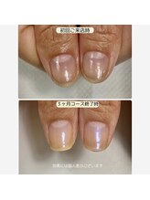 ルームイチマルイチネイルズ(Room101Nails.)/自爪育成・最強のネイルケア鳥取