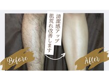 ダンディラボ(Dandy Lab)の雰囲気（うぶ毛から剛毛の方まで脱毛可能♪まずはご相談ください！）