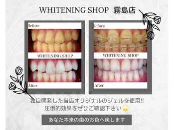 ホワイトニングショップ 霧島店