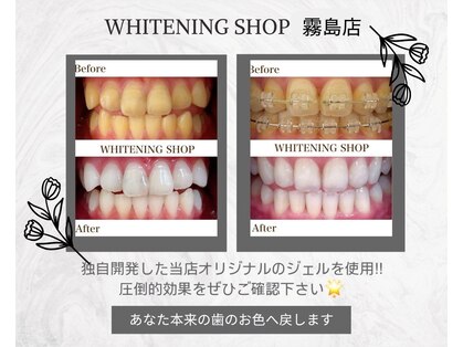 ホワイトニングショップ 霧島店の写真