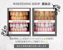 ホワイトニングショップ 霧島店