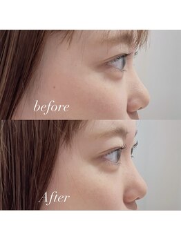 ウワプラス(UWA+)/まつげパーマ