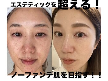 トータルエステティック ジョワイユ(JOYEUX)の写真/【お肌が変わると人生が変わる】大人の肌は、ここから変えられる！美肌管理