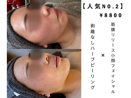 きぃ オリジンプラス(きぃ origin+)の写真