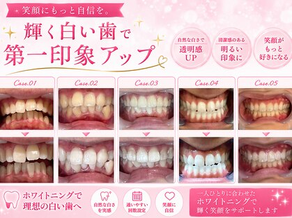 ルカノン(le canon)の写真