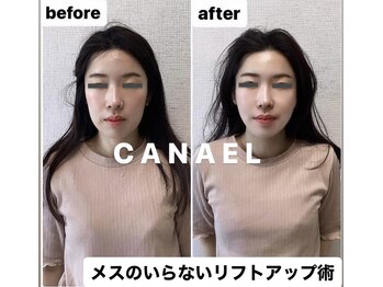 カナエル(CANAEL)の写真/頭蓋骨小顔矯正で頭皮からしっかり引き上げお顔のたるみ、もたつきをケアしフェイスUP！