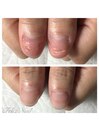 隠す爪から見せる爪へ