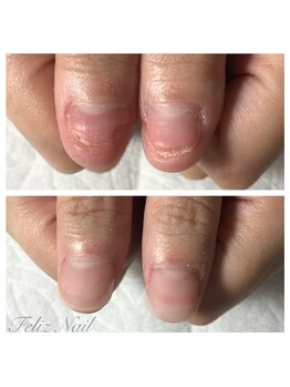 フェリス(Feliz)/隠す爪から見せる爪へ