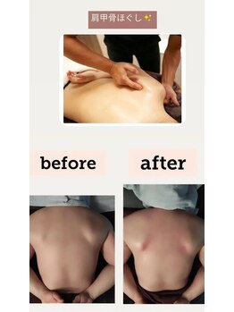 エクラ(eclat)/肩甲骨はがし