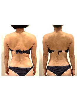 TMサロン 赤坂/ガチガチ首肩スッキリキレイに！