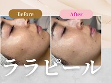 フェルナ 天満橋店(FERNA)の雰囲気（ララピールBeforeAfter☆）