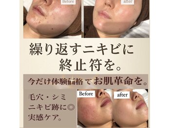 エム(M)
