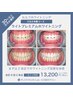 自然な白さ♪2番人気【ライトプレミアムホワイトニング】2来店(合計48分)