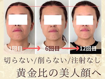 スウ(suu.)の写真/「変わりすぎて笑える！」骨格の歪み矯正で根本からキレイなＶ字フェイスラインに！実年齢より若い印象へ☆