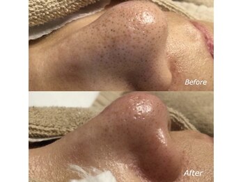 毛穴専科/毛穴洗浄+白玉ワックス メンズ◎