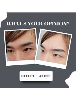 アイアンドアイ(ai&ai)/