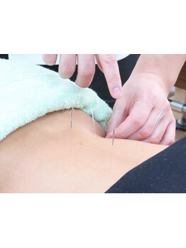 鍼灸施術を受けたい