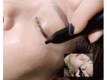 アイラッシュ クレセント(eyelash CRESCENT)/シミケア☆ホワイトアウト