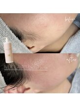 ノン(Non.)/ヌクレールフェイシャルワックス