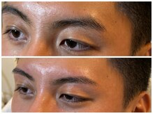 スリーピース(3Peace)/ストレート眉 Before/After