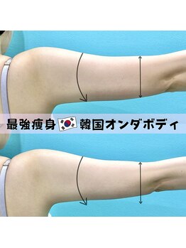 カンナムビューティー 新宿 代々木/オンダリフト/新宿/ララピール