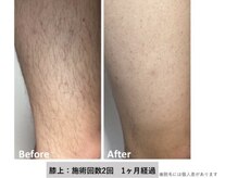 ダイアナ 出雲店(Daiana)/１回も効果がすごい！のお声