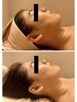 エイシスグロウ(asis glow.)/効果写真