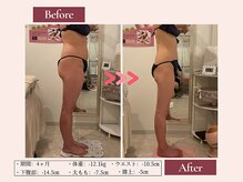 リムサロン(RIMSALON)/