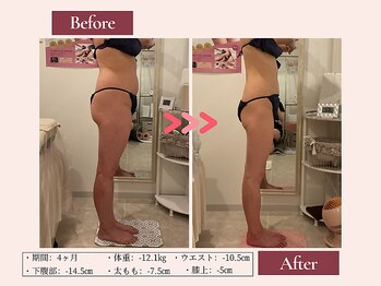 リムサロン(RIMSALON)/