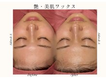 サロンドエー 帝塚山(Salon de A)/艶・美肌ワックス