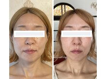トッコボディケアの雰囲気（顎関節を整え、立体的なお顔へ！肩こりも楽に）