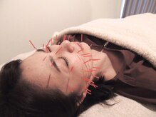 たけの子鍼灸整骨院 自由が丘院/