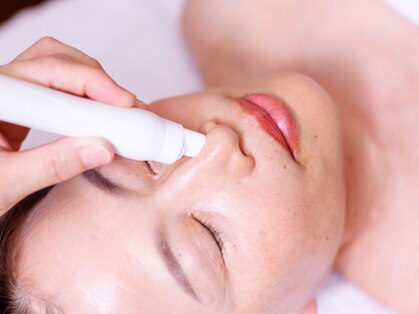 ルシェノン(Le Chainon)の写真