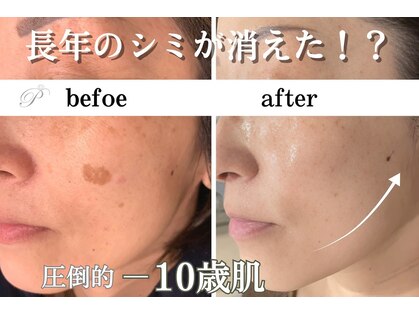 パールホワイトニングサロン 大和店の写真