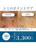 【期間限定50％OFF】シミ集中ケアオプション　6,600円→3,300円※単品不可