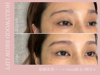 ルーム(room)/ハリウッドブロウリフト