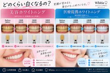 ホワイティア