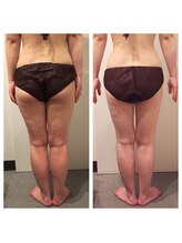 サロン リーナ 北千住店(Salon Lena)/西洋式深層強力リンパ＋体質整鍼