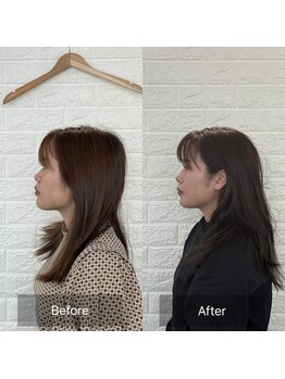 ティエル(Tielu)/小顔矯正6回の変化