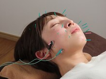 ハリラボ(hari Lab.)の雰囲気（電気と美容鍼で筋肉を緩めて、内側からも肌質サポート♪）