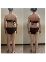 オンディーヌ 名古屋/劇的に!!エステ通いは短期に卒業