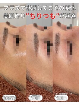 ベルファーム(Belle Femme)/継続しようプラズマシャワー♪