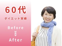 スロース鍼灸整体院(SLOTH鍼灸整体院)/60代 ダイエットBefore/After