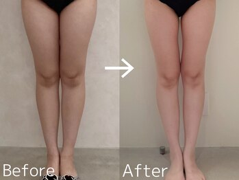 カレンジェビューティー(CarengeBeauty)/スリムカッター下半身