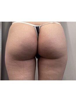 美脚になりたい