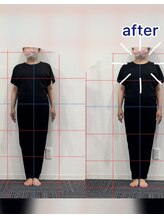 スタジオループ 博多(Studio Loop)/姿勢改善ヤムナbefore&after