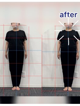 スタジオループ 博多(Studio Loop)/姿勢改善ヤムナbefore&after