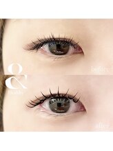 ロブ 自由が丘(LOB)/アンドヘルシー160本