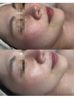 ココリール/スッピン美人