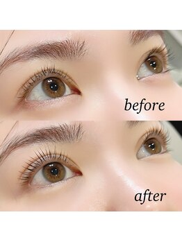 アイ(_i)/ラッシュリフト